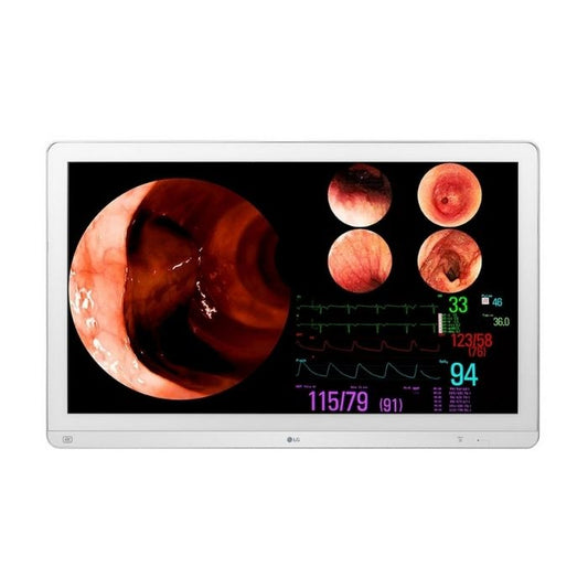 Monitor quirúrgico LG 31.5 (80.01 cm) 4K IPS